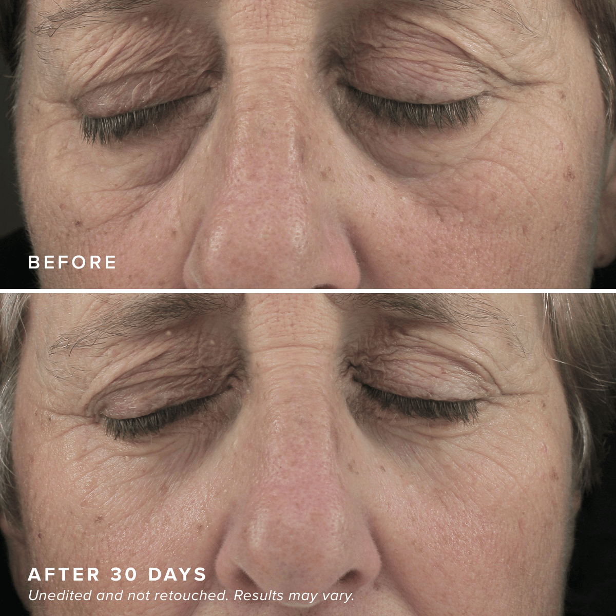 Revitalizing Eye Brighteners