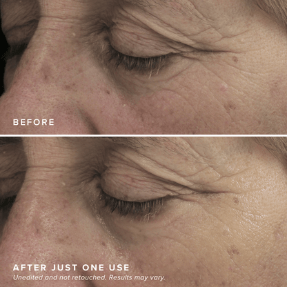 Revitalizing Eye Brighteners